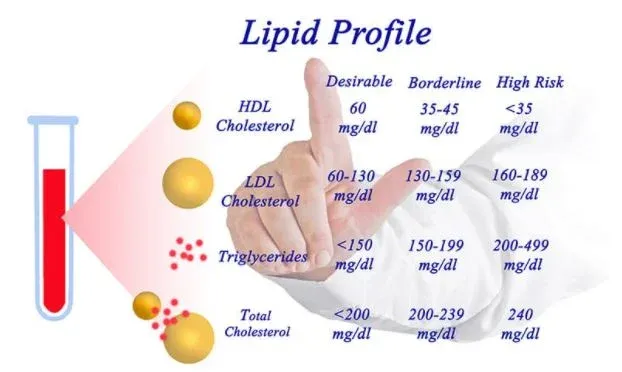 Lipid profile Test